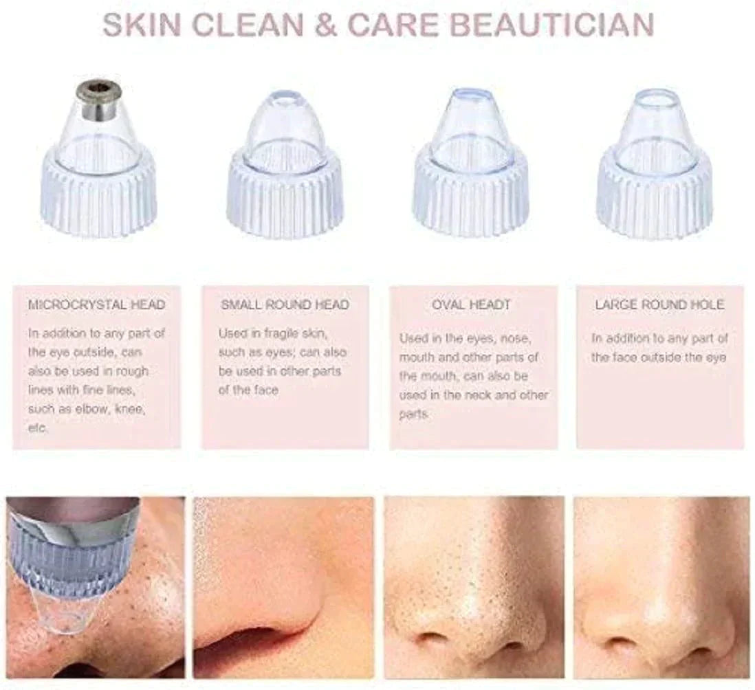 PIMPLE & BLACKHEAD REMOVER